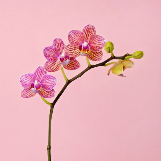 PHOTOWALL / Pink Orchid (e316046)